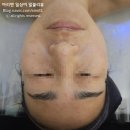 예쁜여우피부관리 이미지