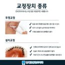 예플란트치과 네이버블로그