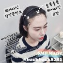 선헤어라인 이미지