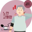 노인 고혈압, 심장에 직격탄… 이미지