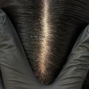 6 | 김포가르마커버 6개월후기