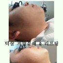 더 예쁨 이미지