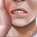 "치아결손 있으면 암 위험 높아…구강세균이 장기에 직접 영향" 이미지