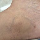 아토건 | 닥터아토 가려움이별크림 후기 아이 볼 홍조와 성인 건조피부에 써본 보습크림