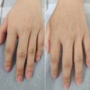 손*진 - 미추홀구 숙골로43번길 30 | 꼬질꼬질한 손 끝 탈출! 왁싱민둥에서 매끈해진 여자 손 왁싱 솔직 후기