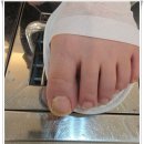 뷰티 라이프 샵 | 광주 문제성 발톱 정복 광주발톱무좀샵 뷰티업라이프 페디네일 광주본점 방문 후기