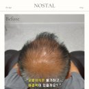 노스탈