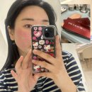 리즈멍 | 대구 동성로 피부과 리쥬란HB2cc + 리즈네2cc 후기