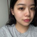 기쁨한의원 | [천안패인흉터치료] 신부동한의원 흉터 치료 2회차 후기