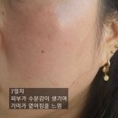비타약국 | 약국기미크림 데이셀 닥터비타 찐 사용후기
