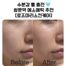쌍문삼성 | 쌍문역 피부관리샵 추천 ㅣ 피부관리 전문 [로즈마리스킨케어] ㅣCO2수분집중관리 받고온 찐 솔직 후기