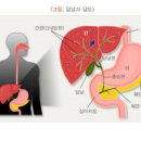 명치 통증 누르면 아래 아플때 원인은 이미지