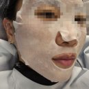 삼성바른병원 | 삼성역피부과 삼성역슈링크후기 다운타임 효과 300샷 내돈내산