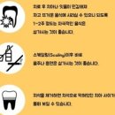 스케일링, 이게 진짜 효과가 있을까? 치아 건강의 비밀을 파헤쳐보자!