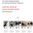 해결 | 긴장성 두통 치료 어지러움 증상 해결후기