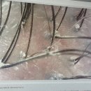해피랑힐링센터 파장지점 | 동탄두피케어 WT메소드 동탄점 육아에 지쳐 두피관리 받고 온 후기