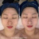 씨유 해운대대우2차점 | 페이슬림 부산해운대점 | 해운대피부관리 해운대리프팅 알테온 리프팅 후기 부산예신관리 추천