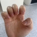 루헤네일