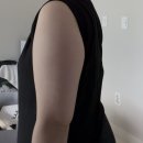 만세로약국 | 팔+ 부유방 지방추출주사 시술당일~1주차 후기 :: 소요시간, 통증, 멍,붓기, 효과, 일상생활