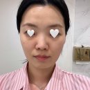 (주)알앤디프로젝트 | [대전/경락] 윤곽관리로 메추리알 만들기 프로젝트_끌리메 대전관저점 윤곽관리 후기