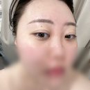 정천중학교 | 올가드림뷰티 화서점 : 모공 디톡스/스케일링, 모낭충 검사/관리 후기