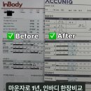 뷰티 크리에이터 씬님, 마운자로 1년 만에 17kg 감량…"내장지방도 16에서 3으로" 이미지