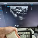 삼성메디칼의료기 이미지