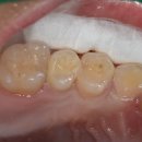 서울이오스치과교정과치과의원 이미지