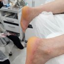 레푸스 중곡점 | 레푸스 중곡점에서 발 관리하기