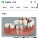 하이치과기공소 이미지