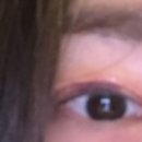 외 제 | 소세지눈 재수술 10-12 일차 + 눈화장 후기 (언제부터)