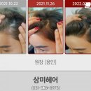 헤어샵 원장님 제보한 발모후기(사진) 구경하세요~ 약2천여건 후기제보