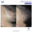 탈모왕 광주점 이미지