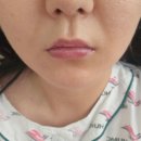 라인아트의원 | 피부 고민 해결! 피부과 유목민 정착지 &#34;청담미닛의원&#34;리얼 방문 후기