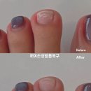 엄네일 | 💅 일산네일샵 엄네일 손·발톱 손상복구 케어, IBX 시스템 체험기