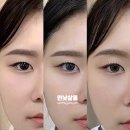 시현광택 이미지