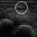 충북수지 이미지
