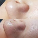 솜 피부클리닉 티스토리