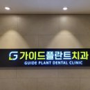가이드본치과의원 | # 부천 원종동 가이드 플란트 치과 의원 _ 스케일링...및 크라운 마취 진료 및 치료 필요성 후기 일지 기록