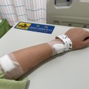 내성교차로 | 편도 제거 수술 후기 - 1주차(운동, 식이, 비용, 통증)