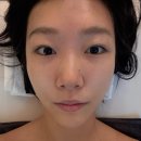 이레 | 성남 야탑피부관리 이레바디스킨 작은얼굴윤곽관리 후기