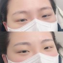 나린브로우 이미지