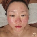 6707 | [잠실] 송파피부관리 안나뷰띠끄 : 윤곽플래닝 솔직 후기