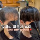 남자 모발이식실패 부작용 후기 커버 붙임머리 잘하는곳