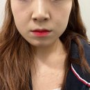 닥터에버스의원 미사점 | 미사역 피부과 닥터에버스 인모드 받고 온 후기!