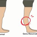 크리스워크아웃 이미지