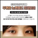 트로이성형외과 이미지