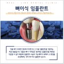 리얼라인치과의원 이미지