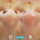 피부에설레다 이미지