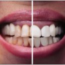 일산스마트치과의원 이미지